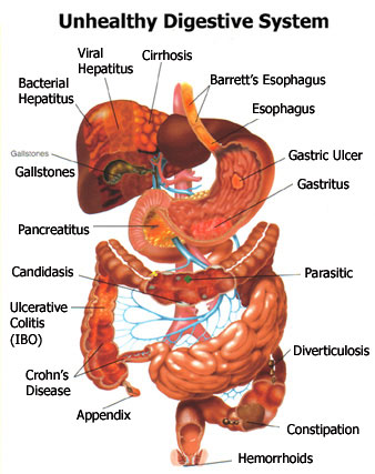 digestive disorders and disease